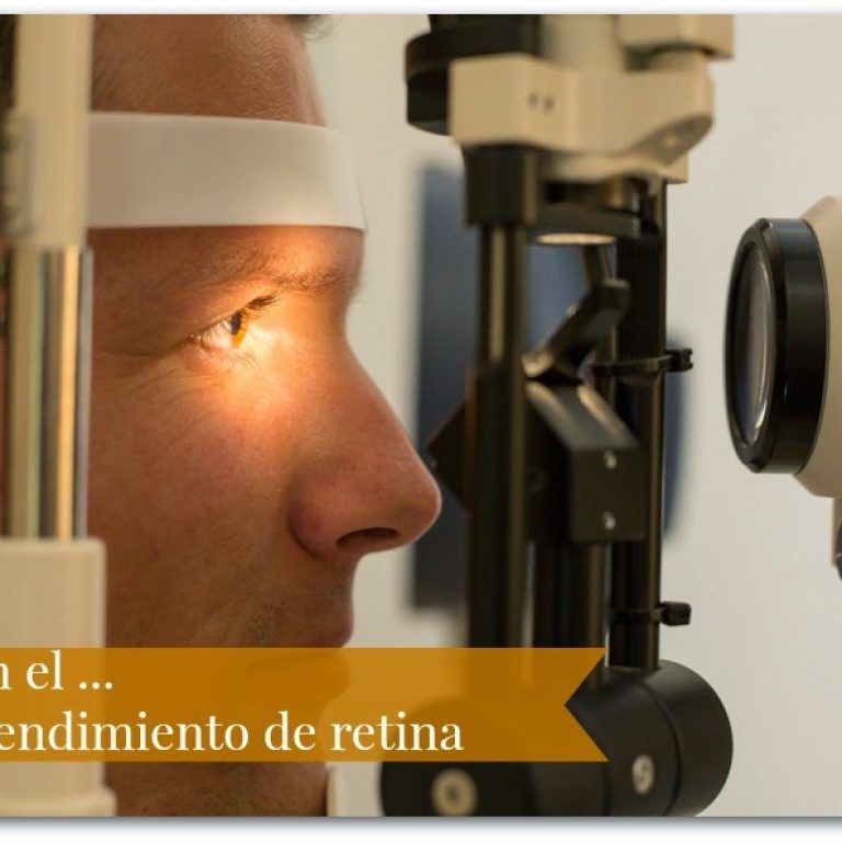 desprendimiento de retina